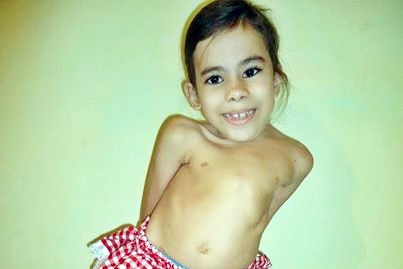 Menina precisa de doações para fazer cirurgia de R$ 300 mil
