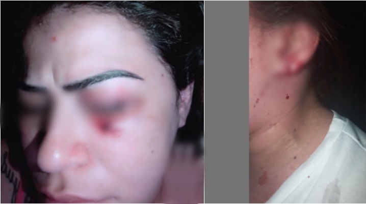 Piauiense que era agredida pelo namorado é resgatada em São Paulo