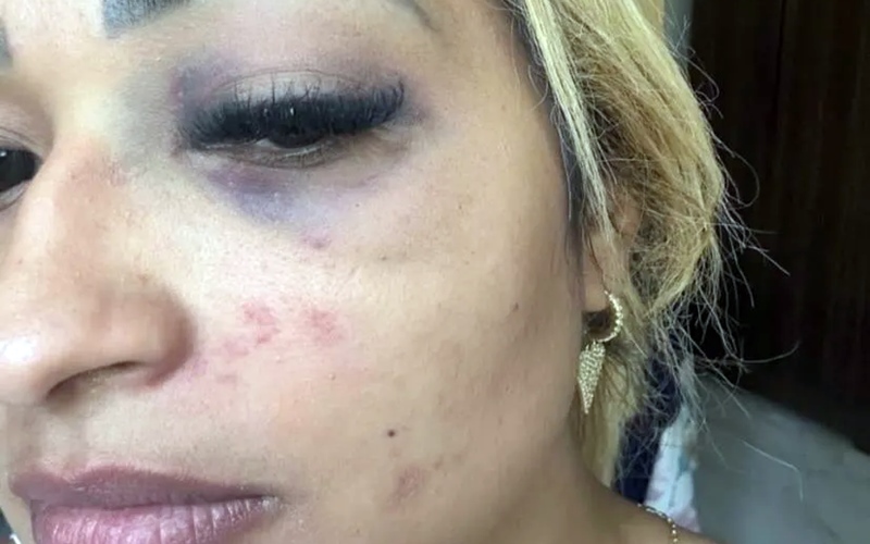 Piauí – Empresária denuncia violência doméstica do marido