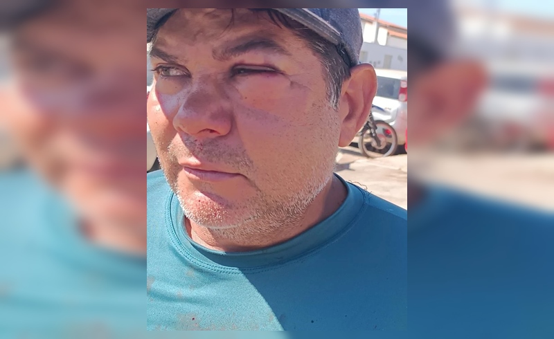 Servidor de prefeitura é agredido por ex-vereador ao recolher gado solto na rua