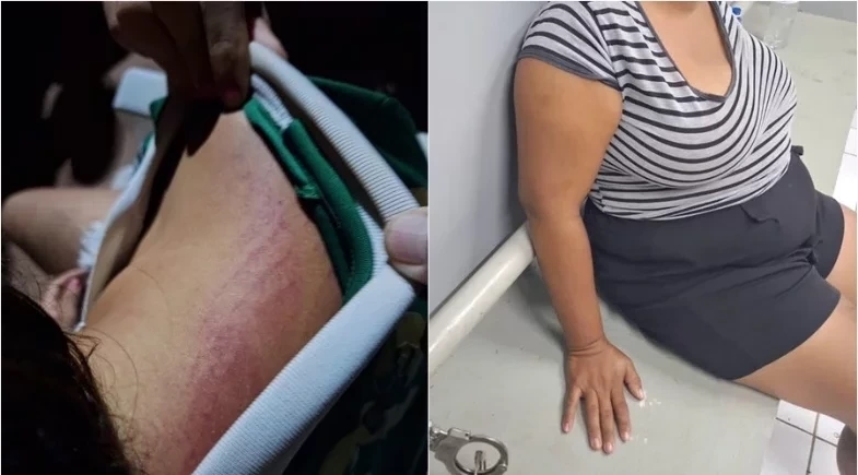 Criança de 12 anos é espancada pela mãe e fica com o rosto ferido